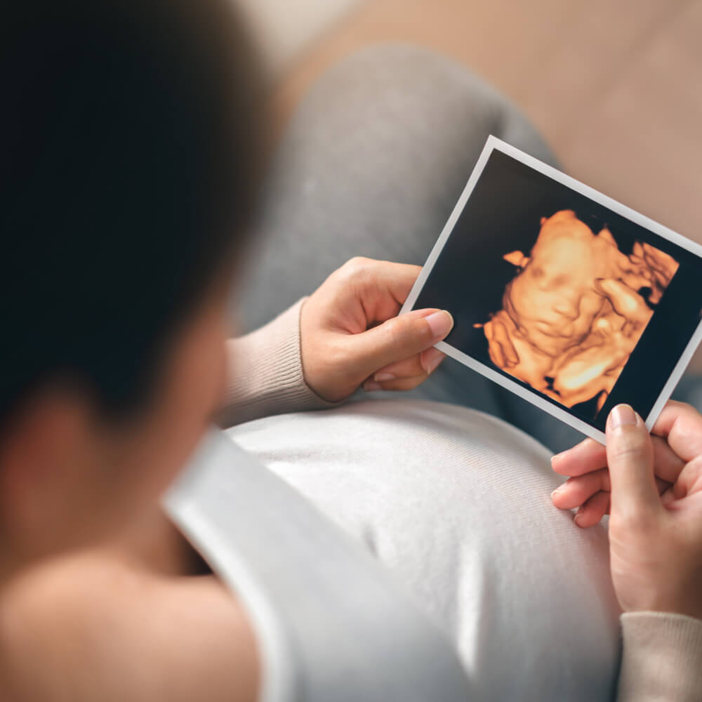 Asian pregnant woman holding ultrasound 4d scan